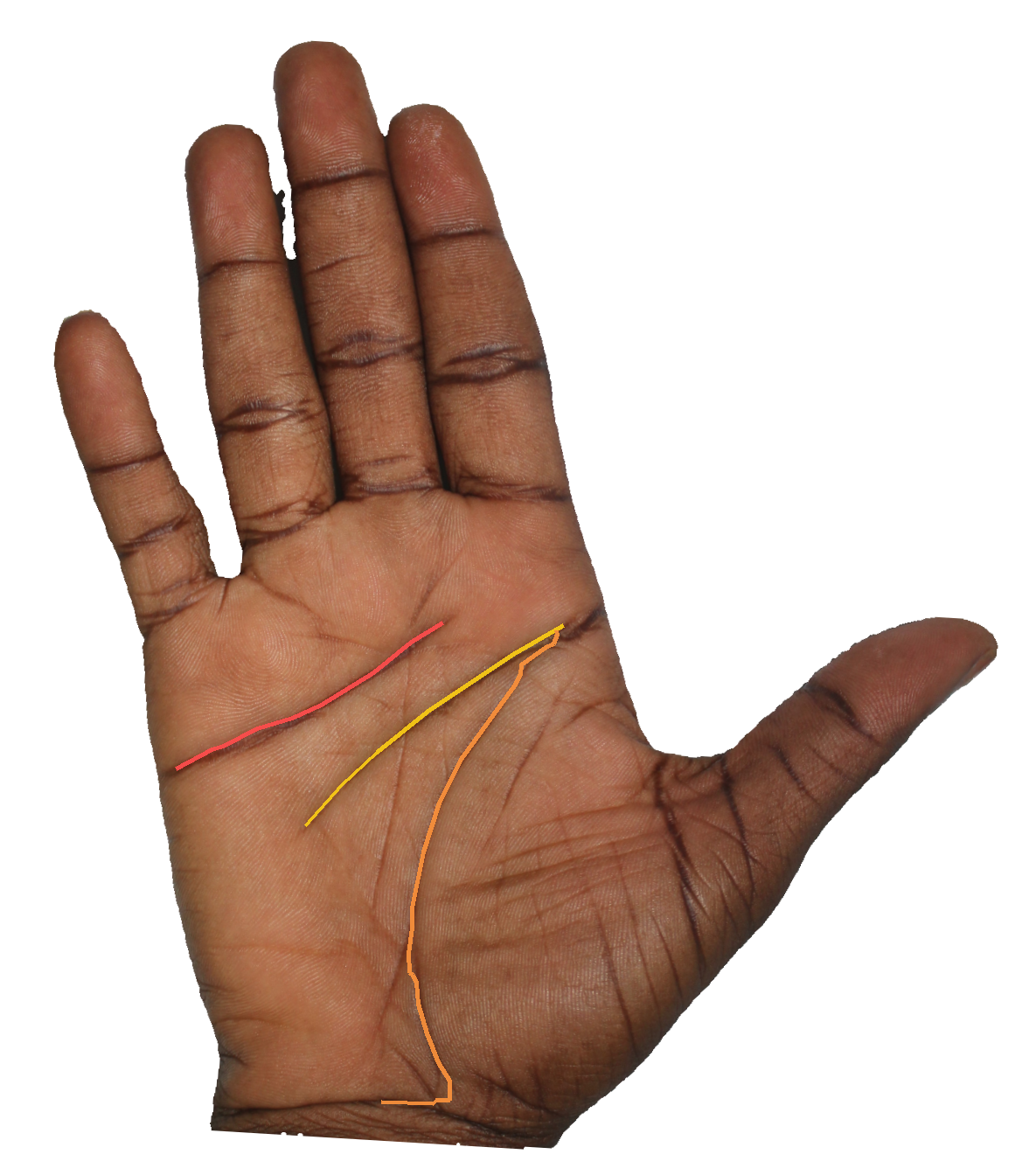 Palm reading overlay for: How does the Mount of Apollo read my relationship to public recognition?
