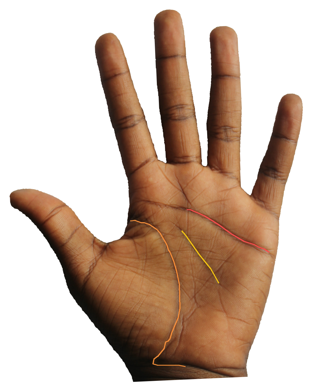 Palm reading overlay for: Does the Mount of Apollo indicate artistic talent waiting to be developed?