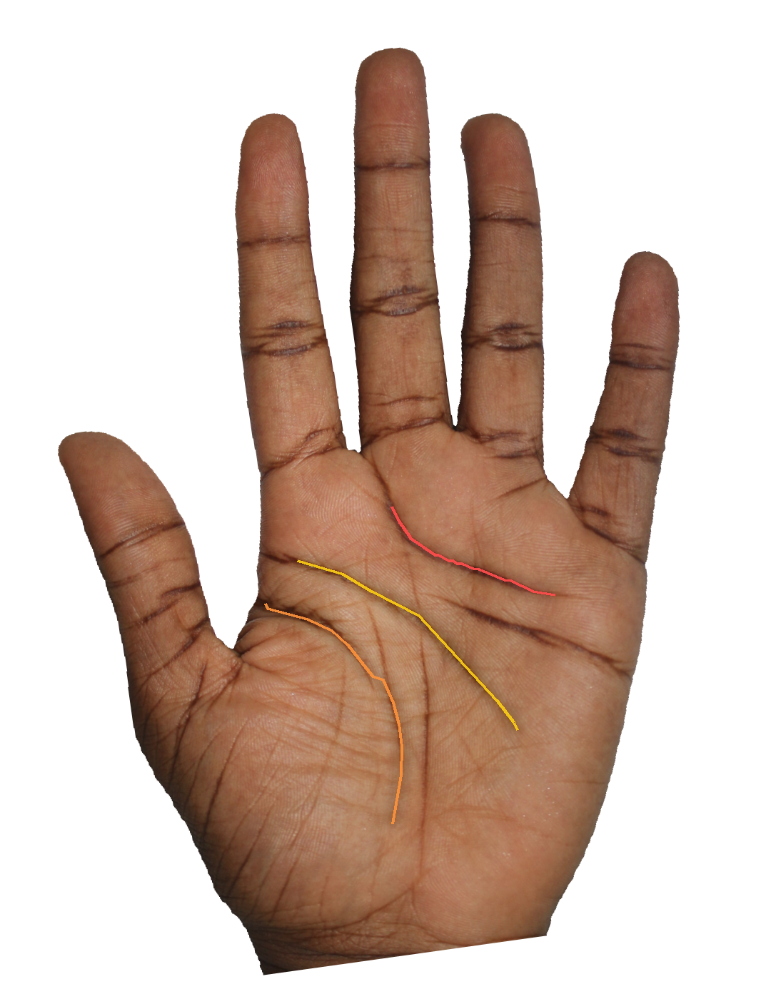 Palm reading overlay for: Do my marriage lines indicate one durable partnership or several?