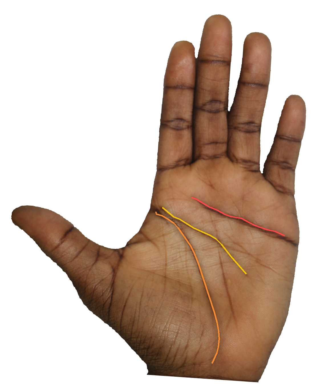 Palm reading overlay for: How does my life line frame the relationship between body and resilience?