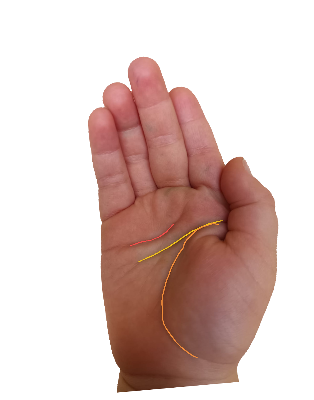 Palm reading overlay for: What does my life line say about resilience?